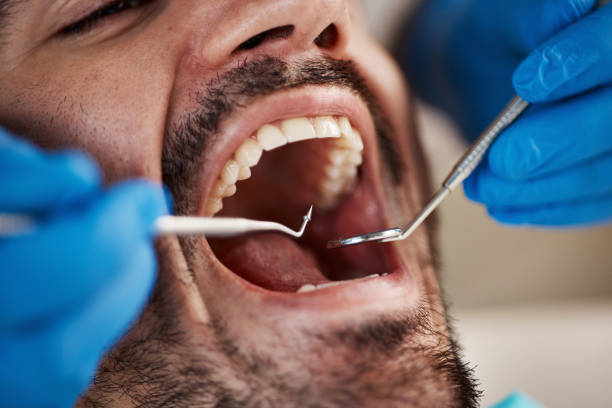 Best Emergency Dental Care for Trauma or Injury in Shelby, MI